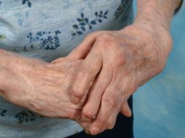 aromatherapy for arthritis