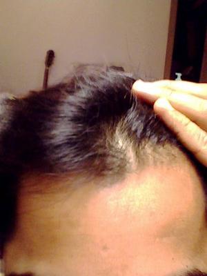 My Hair